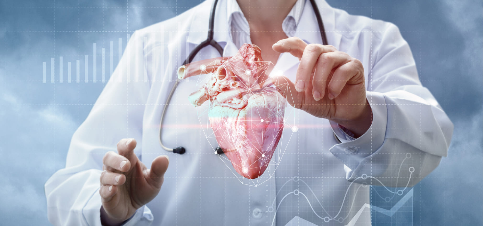 avances-en-cardiologia-intervencional